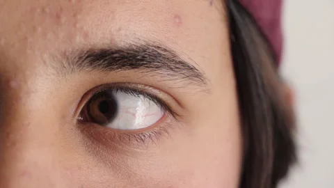 Blink, eye and thinking with closeup of boy for optometry appointment or vision Video stock 336674761