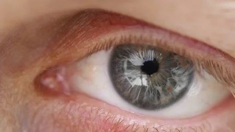 Blinking eye Video stock 81483859