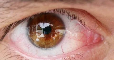 Blinking eye Stock Footage 81484870