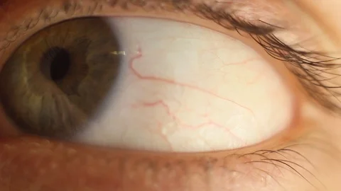 Blinking male eye close-up looking around. red artery on the eyeball macro Stock Footage 108482066