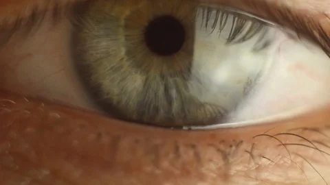 Blinking male eye close-up looking around. red artery on the eyeball macro Stock Footage 108482110