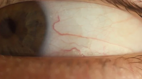 Blinking male eye close-up looking around. red artery on the eyeball macro Stock Footage 108538384