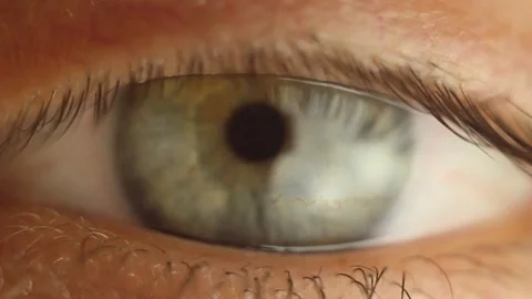 Blinking male eye close-up looking around. red artery on the eyeball macro Stock Footage 108580393