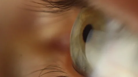 Blinking male eye close-up looking around. red artery on the eyeball macro Stock Footage 108580452