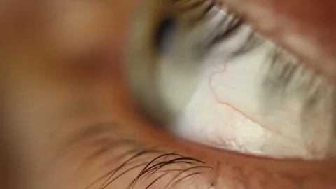 Blinking male eye close-up looking around. red artery on the eyeball macro Stock Footage 108617210