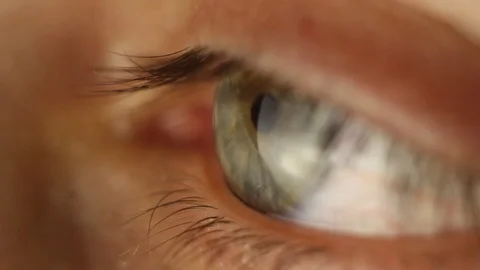 Blinking male eye close-up looking around. red artery on the eyeball macro Stock Footage 108617279