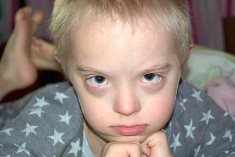 Blond boy with down syndrome looking at the camera. Stock Photos