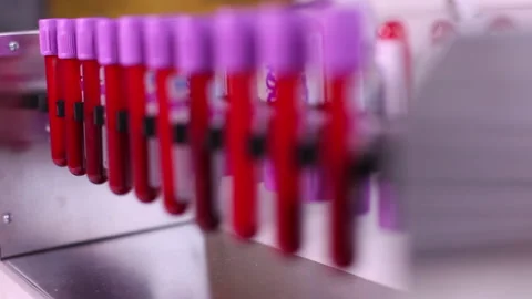 Blood 02 Stock Footage 133834421