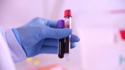 Blood 03 Video stock 133834403