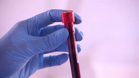 Blood 04 Video stock 133834391