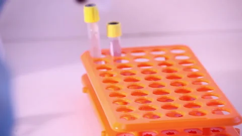 Blood 05 Stock Footage 133834399