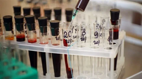 Blood analysis Stock Footage 8096755