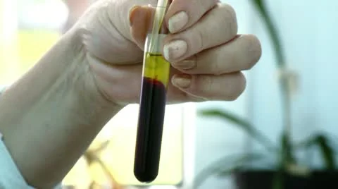 Blood analysis in laboratory Stock Footage 10858672