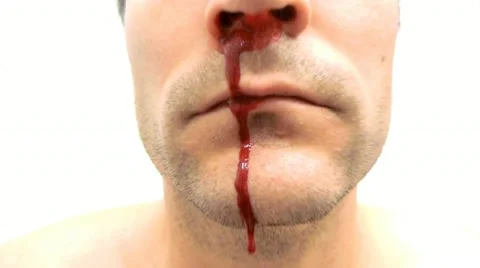 Blood and Gore Stock Footage 11277331