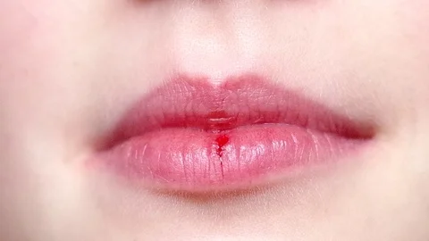 Blood on baby's lips Stock Footage 123861406