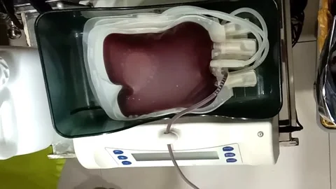 Blood bag 库存影片 308783586