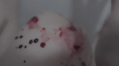 Blood on a broken knee Stock Footage 57839099