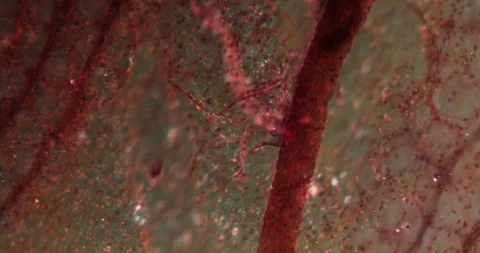 Blood capillaries in Darkfield Stock Footage 146687670