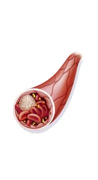  Blood capillary, drawing Representation of the different elements of the ... Stock Photos