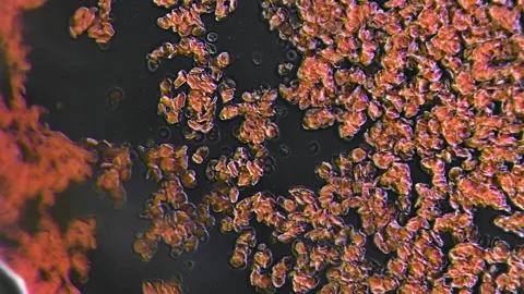 Blood Cells Clotting under a Microscope Close Stock Footage 162521367