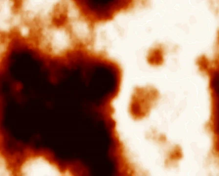 Blood Cells 库存影片 101676