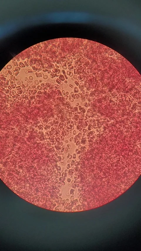 Blood cells moving under microscope Vídeos de archivo 331517083