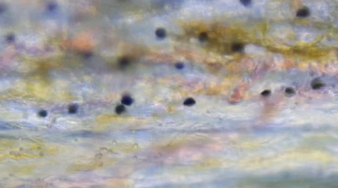 Blood Cells Under Microscope Video stock 41169977