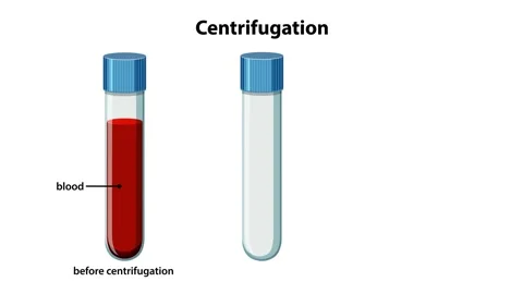 Blood Centrifugation Process and Component Separation Video stock 329085589