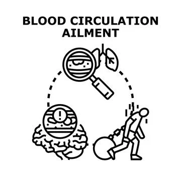 Blood circulation ailment causing vessel problems and bodily burden Stock Illustration