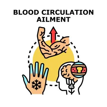 Blood circulation ailment concept with different symptoms Stock Illustration
