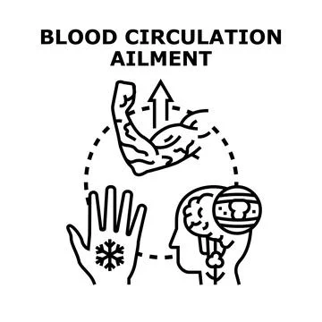 Blood circulation ailment concept with different symptoms Stock Illustration