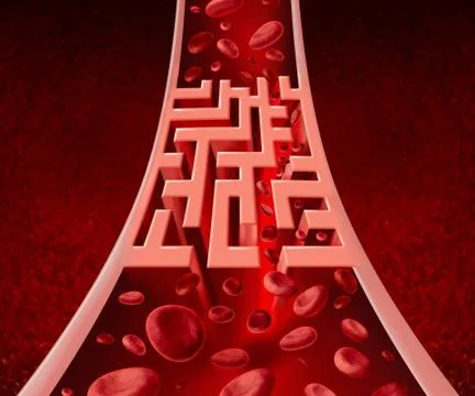 Blood circultation problems Иллюстрация
