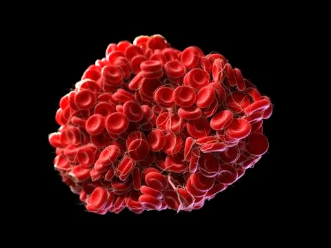 Blood clot, artwork Stock Illustration