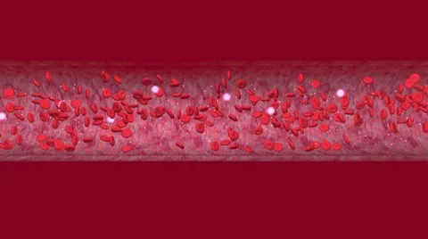 Blood Clot Video stock 10733958