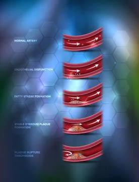 Blood clot formation on an abstract background Stock Illustration