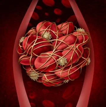 Blood Clot Stock Illustration