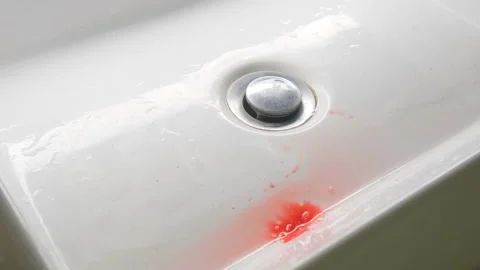 Blood clot in the sink. Problem with gums. Stock Footage 245068615