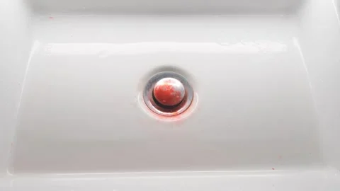 Blood clot in the sink. Problem with gums. Stock Footage 246730521