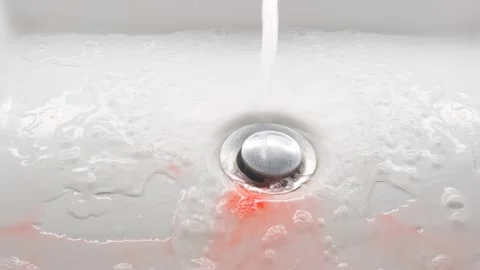 Blood clot in the sink. Problem with gums. Stock Footage 248156991