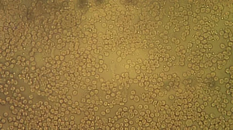 Blood Clots Under Microscope Stock Footage 52843015