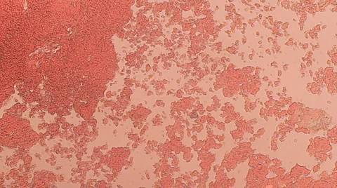 Blood Clotting Wide View 100x (HD) Stock Footage