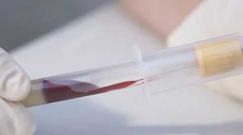 Blood collect Video stock 26090477