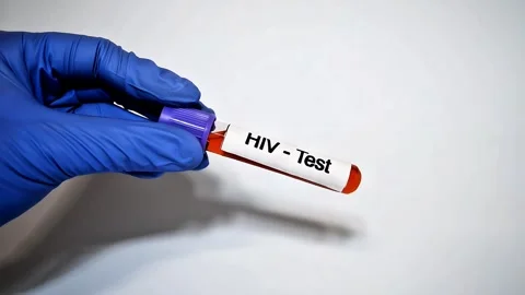 Blood collection tubes HIV test positive results, Medical health concept Stock Footage 307315500