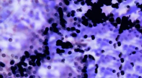 Blood corpuscles a microscope, blood type view macro - Image. Blood Stock Photos