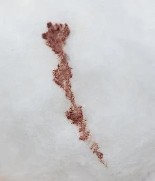 Blood on a cotton patch. Stock Photos