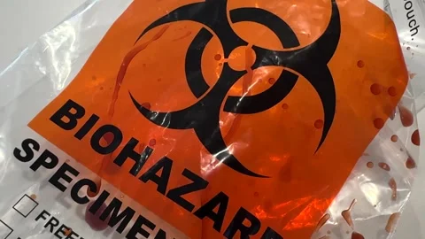 Blood Covered Biohazard Specimen Bag - Panning Shot Stock Footage 301337500