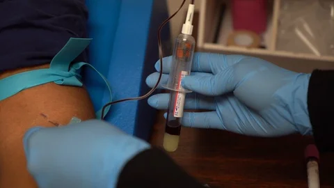 Blood draw Stock Footage 107321564