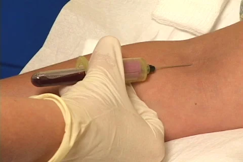 Blood draw sample 02 Video stock 420313