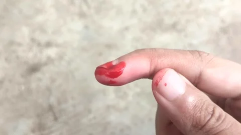 Blood dripping from the fingertip Stock Footage 335263382