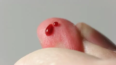 Blood drop from a finger Vídeos de archivo 12441952